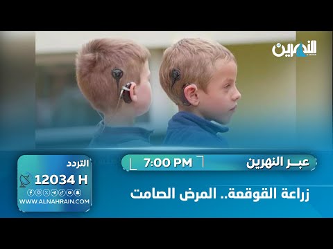  زراعة القوقعة.. المرض الصامت