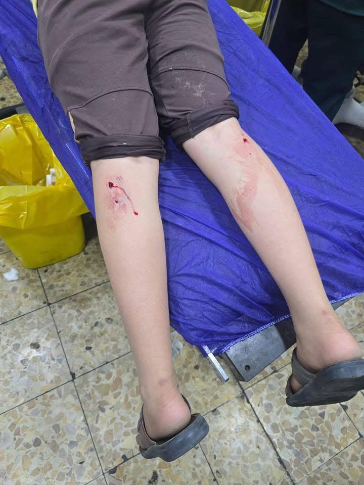 اصابة طفل بجروح خطيرة جراء "عضة" كلب في الموصل 