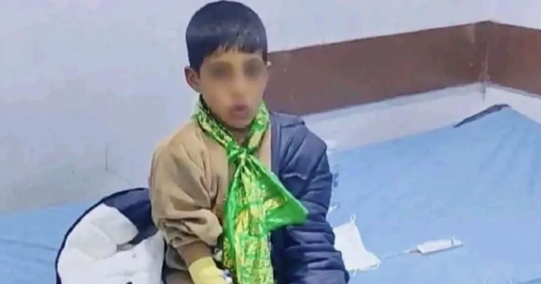 إصابة طفل بداء الكلب بعد 20 يوماً من تعرضه لعضة كلب في بابل