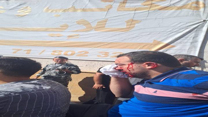 وزير الصحة اللبناني: 8 قتلى ونحو 2750 جريحاً جراء الهجوم السيبراني الاسرائيلي على اجهزة "بيجر"
