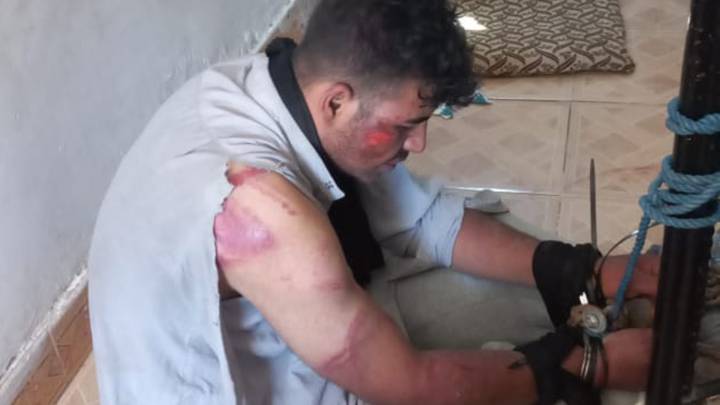 ﻿شرطة ديالى تعلق على تعذيب ممزق صورتي سليماني والمهندس ووالده يؤكد: يعاني من أمراض نفسية